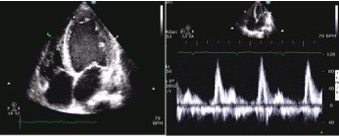 COSA PUO’ NASCONDERE UN ARRESTO CARDIACO?